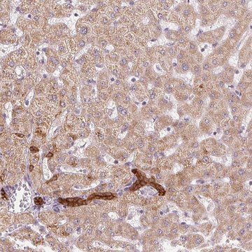 Anti-ARHGAP32 antibody produced in rabbit Prestige Antibodies&#174; Powered by Atlas Antibodies, affinity isolated antibody, buffered aqueous glycerol solution