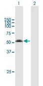 Anti-ARMC6 antibody produced in mouse IgG fraction of antiserum, buffered aqueous solution