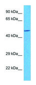 Anti-CYTB (C-terminal) antibody produced in rabbit affinity isolated antibody