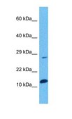 Anti-SPRR1A antibody produced in rabbit affinity isolated antibody