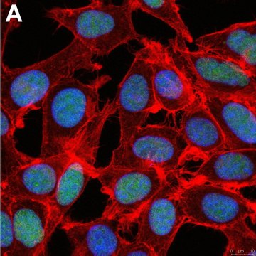 Anti-ZEB1 Antibody, clone 5C20 ZooMAb&#174; Rabbit Monoclonal recombinant, expressed in HEK 293 cells