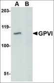 Anti-GPVI (ab1) antibody produced in rabbit affinity isolated antibody, buffered aqueous solution