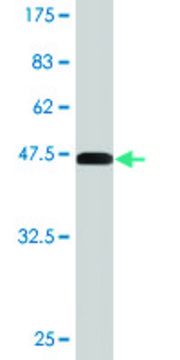 Monoclonal Anti-CTGF antibody produced in mouse clone 2C11, purified immunoglobulin, buffered aqueous solution