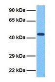 Anti-TRIB1 antibody produced in rabbit affinity isolated antibody