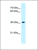 Anti-MAS1 (AB1) antibody produced in rabbit affinity isolated antibody