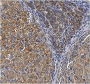 Anti-Mucin-16 (MUC16 Antibody) from rabbit, purified by affinity chromatography