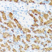 Anti-CTRL antibody produced in rabbit
