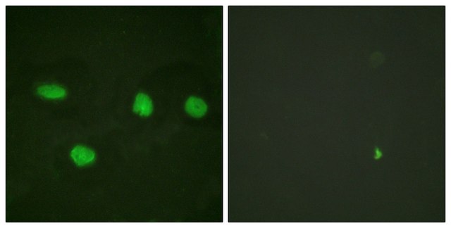 Anti-53BP1 antibody produced in rabbit affinity isolated antibody