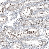 Anti-C1orf112 antibody produced in rabbit Prestige Antibodies® Powered by Atlas Antibodies, affinity isolated antibody, buffered aqueous glycerol solution, Ab2