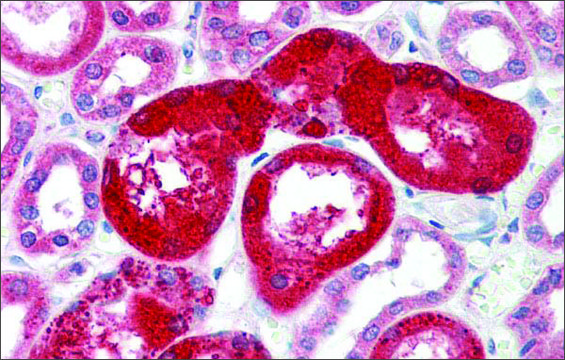 Anti-SOX17 antibody produced in rabbit affinity isolated antibody