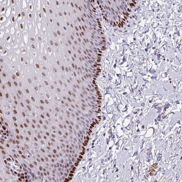 Anti-TMEM215 antibody produced in rabbit Prestige Antibodies&#174; Powered by Atlas Antibodies, affinity isolated antibody, buffered aqueous glycerol solution