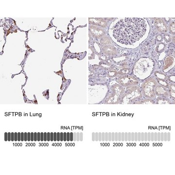 Anti-SFTPB antibody produced in rabbit Prestige Antibodies&#174; Powered by Atlas Antibodies, affinity isolated antibody, buffered aqueous glycerol solution