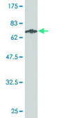 Monoclonal Anti-STEAP1 antibody produced in mouse clone 4F6-1F3, purified immunoglobulin, buffered aqueous solution