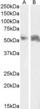 Anti-Perilipin, C-Terminal antibody produced in goat affinity isolated antibody, buffered aqueous solution