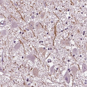 Anti-CNGA3 antibody produced in rabbit Prestige Antibodies&#174; Powered by Atlas Antibodies, affinity isolated antibody