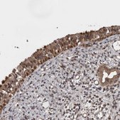 Anti-AOAH antibody produced in rabbit Prestige Antibodies® Powered by Atlas Antibodies, affinity isolated antibody, buffered aqueous glycerol solution