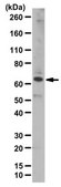 Anti-Zinc finger protein Eos Antibody from rabbit, purified by affinity chromatography