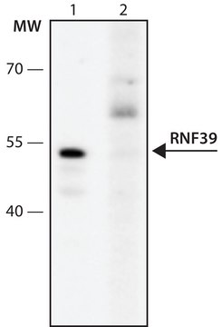 Anti-RNF39 (193-205) antibody produced in rabbit IgG fraction of antiserum