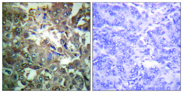 Anti-XPA antibody produced in rabbit affinity isolated antibody