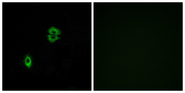 Anti-CCR7 antibody produced in rabbit affinity isolated antibody