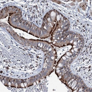 Anti-MRPL14 antibody produced in rabbit Prestige Antibodies&#174; Powered by Atlas Antibodies, affinity isolated antibody, buffered aqueous glycerol solution