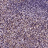 Anti-TOR4A antibody produced in rabbit Prestige Antibodies® Powered by Atlas Antibodies, affinity isolated antibody, buffered aqueous glycerol solution