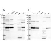 Anti-SUCLG1 antibody produced in rabbit Prestige Antibodies® Powered by Atlas Antibodies, affinity isolated antibody, buffered aqueous glycerol solution