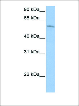 Anti-FAM20C (AB1) antibody produced in rabbit affinity isolated antibody