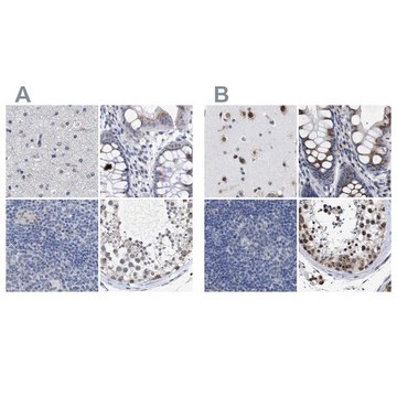 抗-GOLGA2 兔抗 Prestige Antibodies&#174; Powered by Atlas Antibodies, affinity isolated antibody, buffered aqueous glycerol solution, Ab1