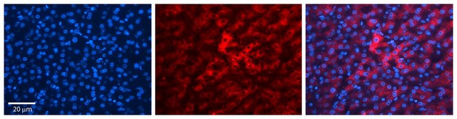 Anti-HP antibody produced in rabbit affinity isolated antibody