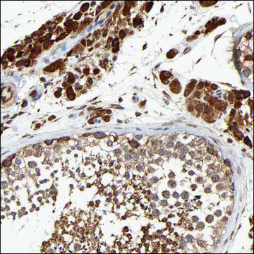 Anti-DDX53 antibody produced in rabbit Prestige Antibodies&#174; Powered by Atlas Antibodies, affinity isolated antibody, buffered aqueous glycerol solution