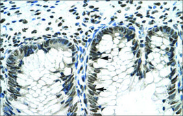 抗-GLI2 IgG fraction of antiserum