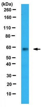 Anti-PKM1 Antibody serum, from rabbit