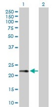 Anti-RPS27A antibody produced in rabbit purified immunoglobulin, buffered aqueous solution