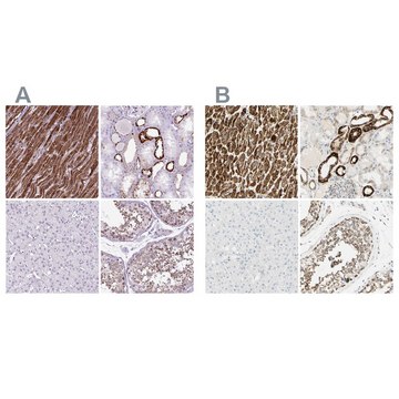 Anti-OXCT1 antibody produced in rabbit Prestige Antibodies&#174; Powered by Atlas Antibodies, affinity isolated antibody, buffered aqueous glycerol solution