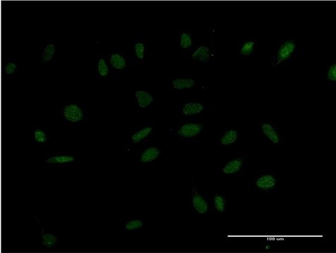 ANTI-HMX2 antibody produced in mouse clone 2D2, purified immunoglobulin, buffered aqueous solution