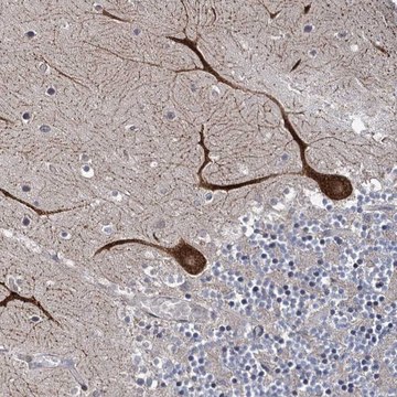 Anti-INPPL1 antibody produced in rabbit Prestige Antibodies&#174; Powered by Atlas Antibodies, affinity isolated antibody, buffered aqueous glycerol solution