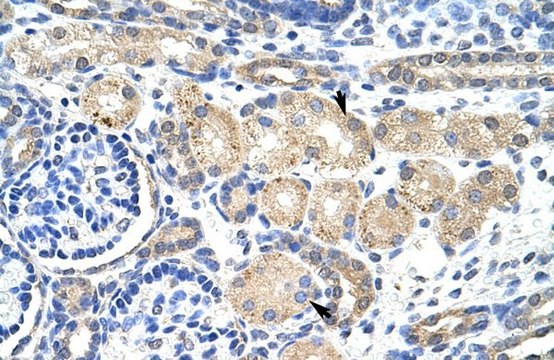 Anti-KCNAB2 (AB1) antibody produced in rabbit affinity isolated antibody