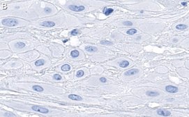 Anti-DHX37 Antibody, clone 3I16 ZooMAb® Rabbit Monoclonal recombinant, expressed in HEK 293 cells