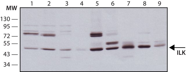 Monoclonal Anti-ILK antibody produced in mouse ~2&#160;mg/mL, clone 65.1, purified immunoglobulin, buffered aqueous solution