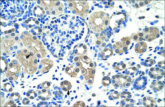 Anti-NR2F2 antibody produced in rabbit affinity isolated antibody