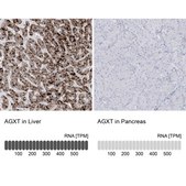 Anti-AGXT antibody produced in rabbit Prestige Antibodies® Powered by Atlas Antibodies, affinity isolated antibody, buffered aqueous glycerol solution