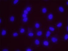 BRCA1 and Estrogen Receptor Alpha PLA® Antibody Kit Powered by Bethyl Laboratories, Inc.