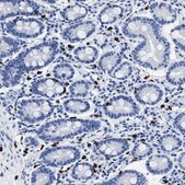 Anti-CER1 antibody produced in rabbit Prestige Antibodies® Powered by Atlas Antibodies, affinity isolated antibody, buffered aqueous glycerol solution