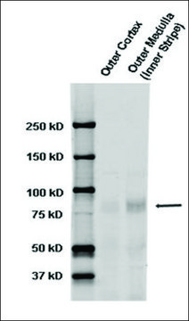 抗-SCNN1A 兔抗 1&#160;mg/mL, affinity isolated antibody