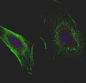 Anti-Derlin-1 Antibody, clone 8G11.2 clone 8G11.2, from mouse
