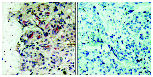 Anti-JAK1 antibody produced in rabbit affinity isolated antibody