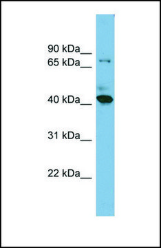 Anti-HERPUD2, (N-terminal) antibody produced in rabbit affinity isolated antibody