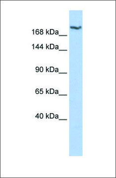 Anti-DSCAM antibody produced in rabbit affinity isolated antibody