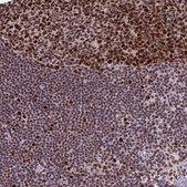 Anti-DUT antibody produced in rabbit Prestige Antibodies® Powered by Atlas Antibodies, affinity isolated antibody, buffered aqueous glycerol solution